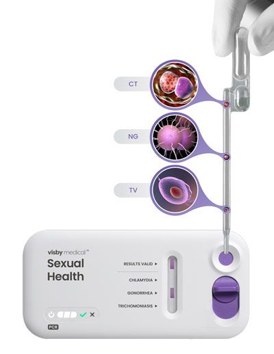 Visby Medical Sexual Health Test and three disease targets.