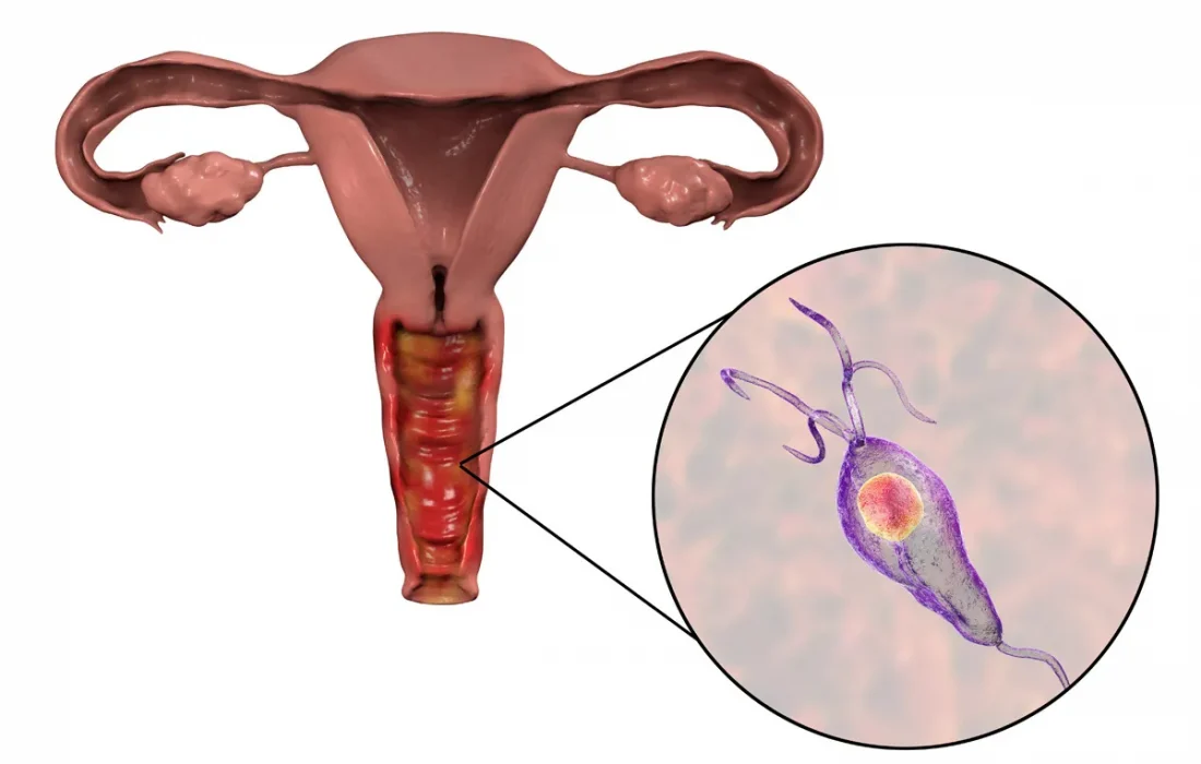 vagina-image